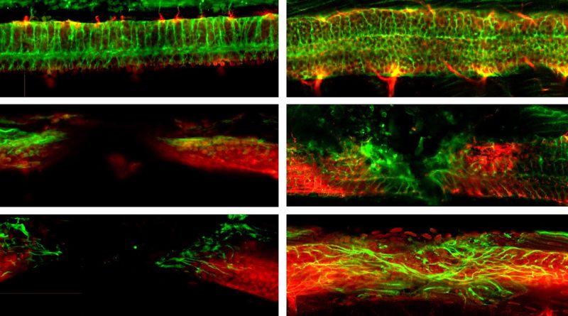 Injectable nanorobots may help heal spinal injuries