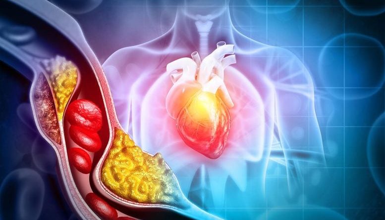 Scientists Discover a Hidden Cholesterol Switch That Could Change How We Treat Heart Disease